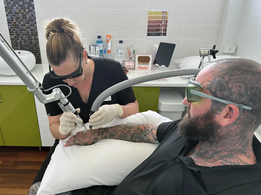Laser tattoo removal treatment in progress at Best Tattoo Removal in Menora, Perth